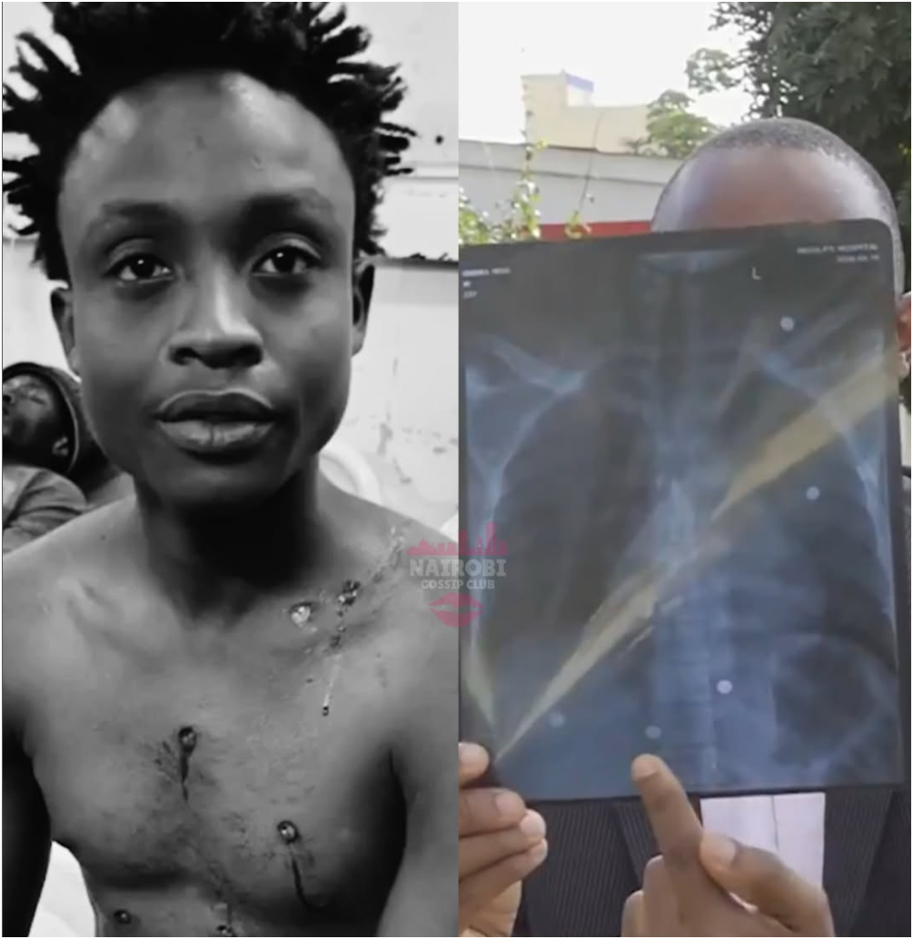 Ruiru boda boda rider recovering after being shot seven times